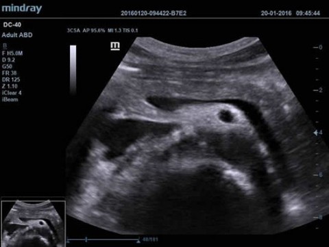 Аппарат ультразвуковой диагностический DC-40 - 388 500 руб.