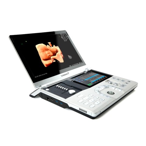 Портативный УЗИ аппарат VINNO 8 - 745 700 руб.