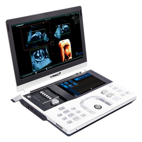 Портативный УЗИ аппарат VINNO 8 - 745 700 руб.