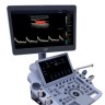 УЗИ аппарат Edan Acclarix LX9 - 2 294 193 руб.