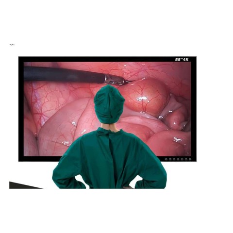 Монитор медицинский UHD 4K Steinmann 8155, 55" - 1 135 627 руб.