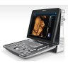 УЗИ сканер портативный Mindray Z60 - 340 000 руб.